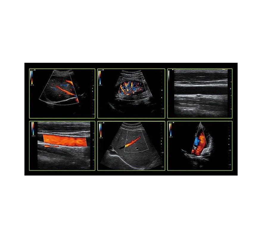 Animal PRegnancy ULtrasound Animal PRegnancy ULtrasound